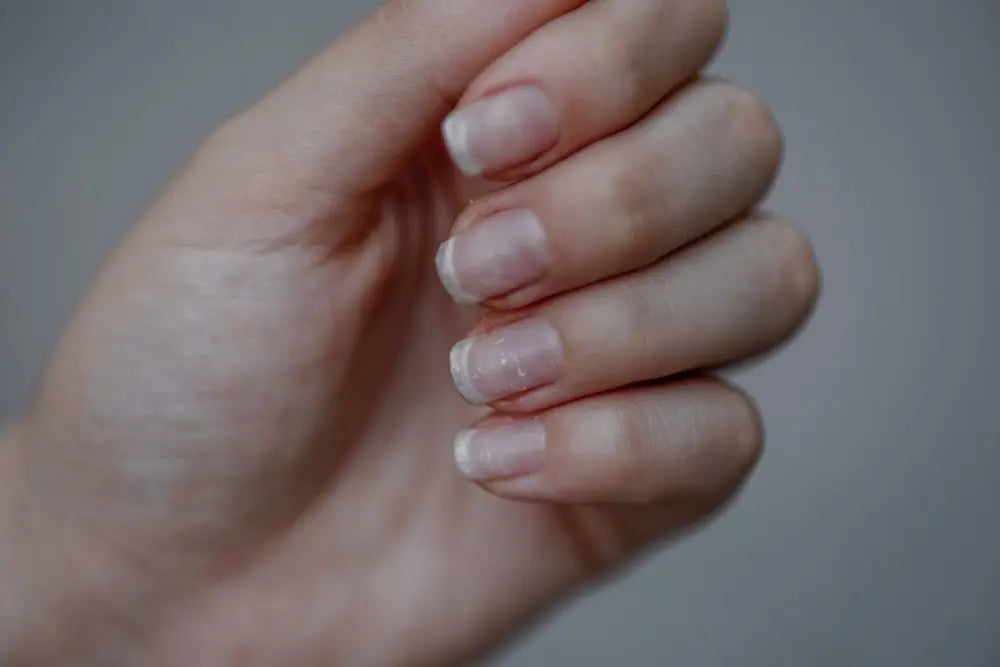 Wie Nagelfolien gegen brüchige und trockene Fingernägel helfen können